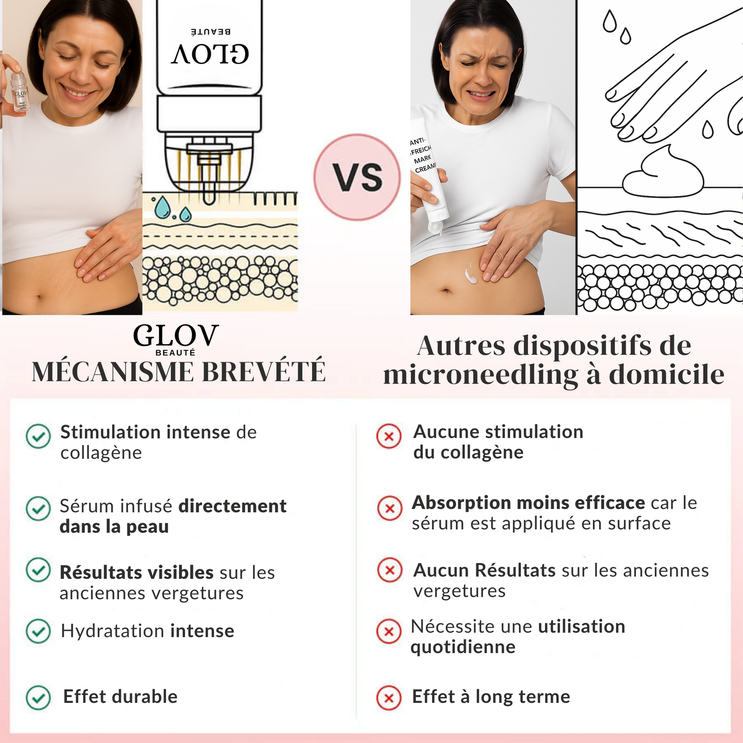 Kit Glov Beauté Vergeture