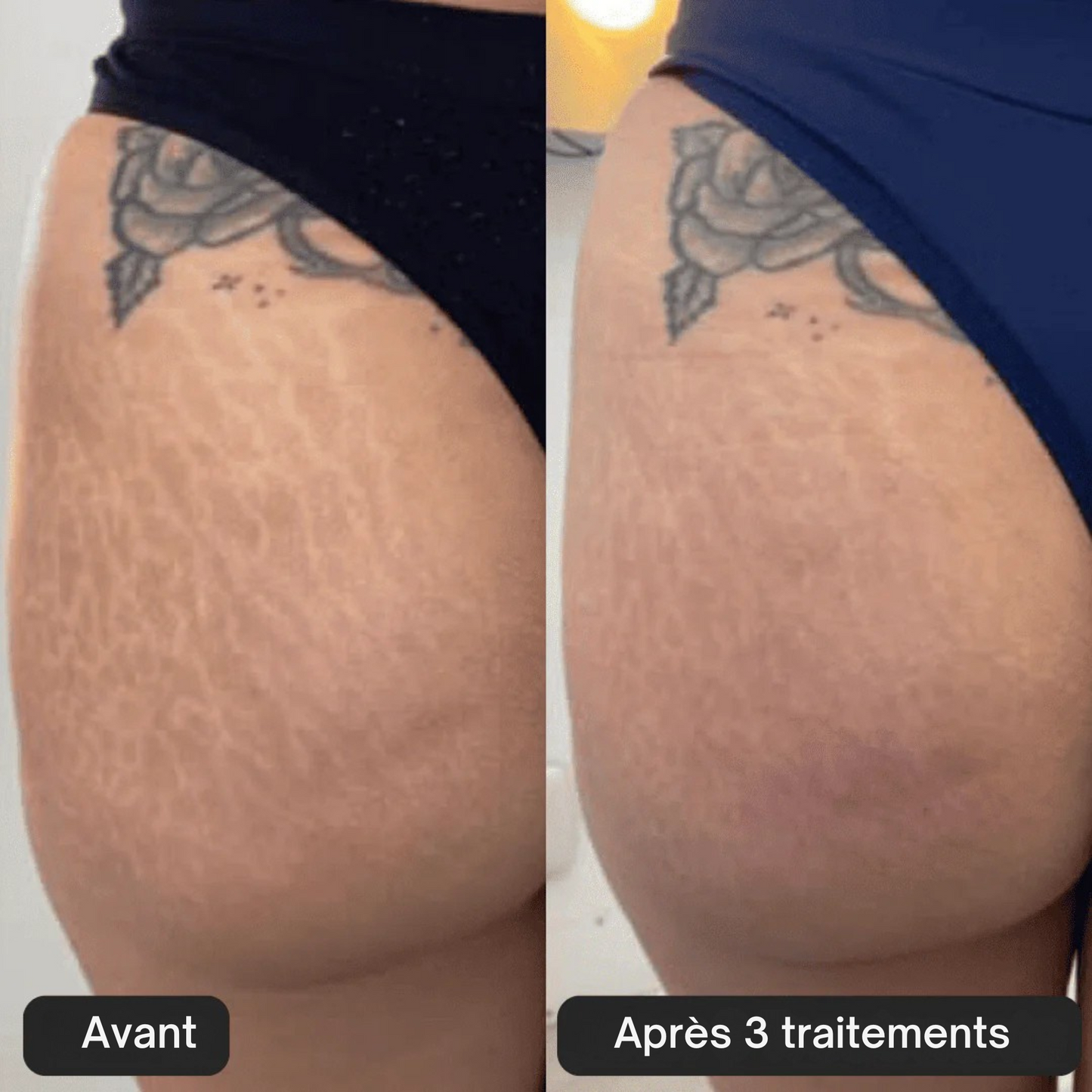 Kit Glov Beauté Vergeture
