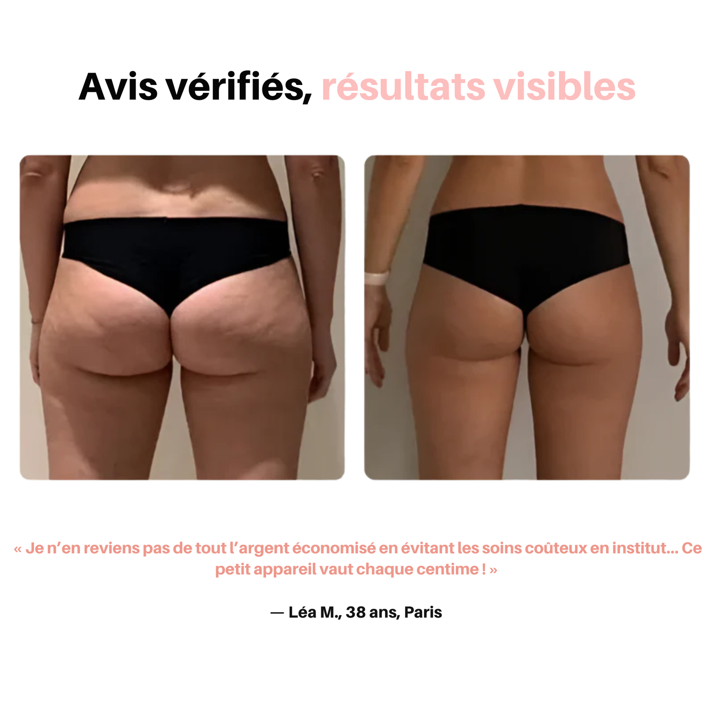 GlovFit | Masseur Anti cellulite