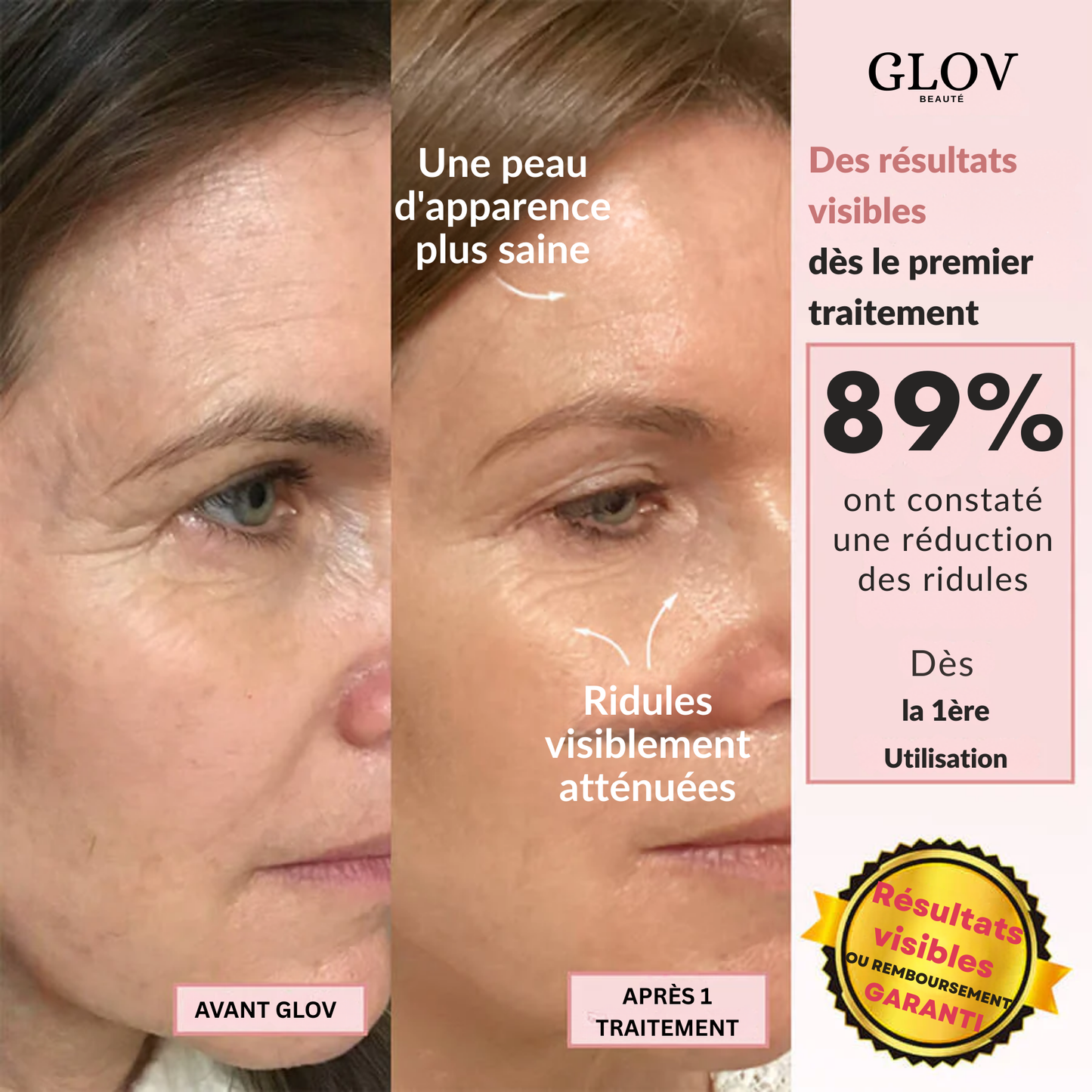 Glov Beauté micro-infusion system