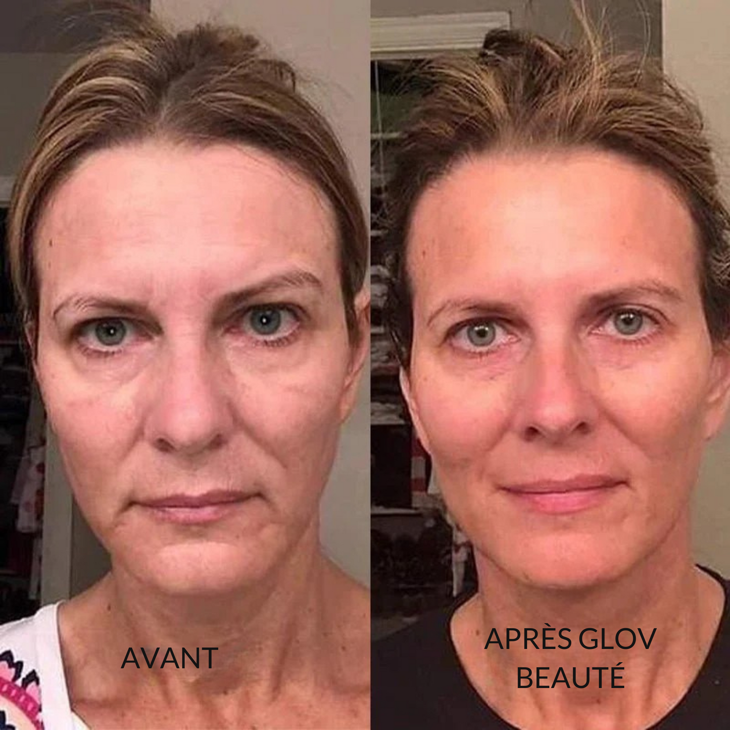 Système de micro perfusion Glov Beauté