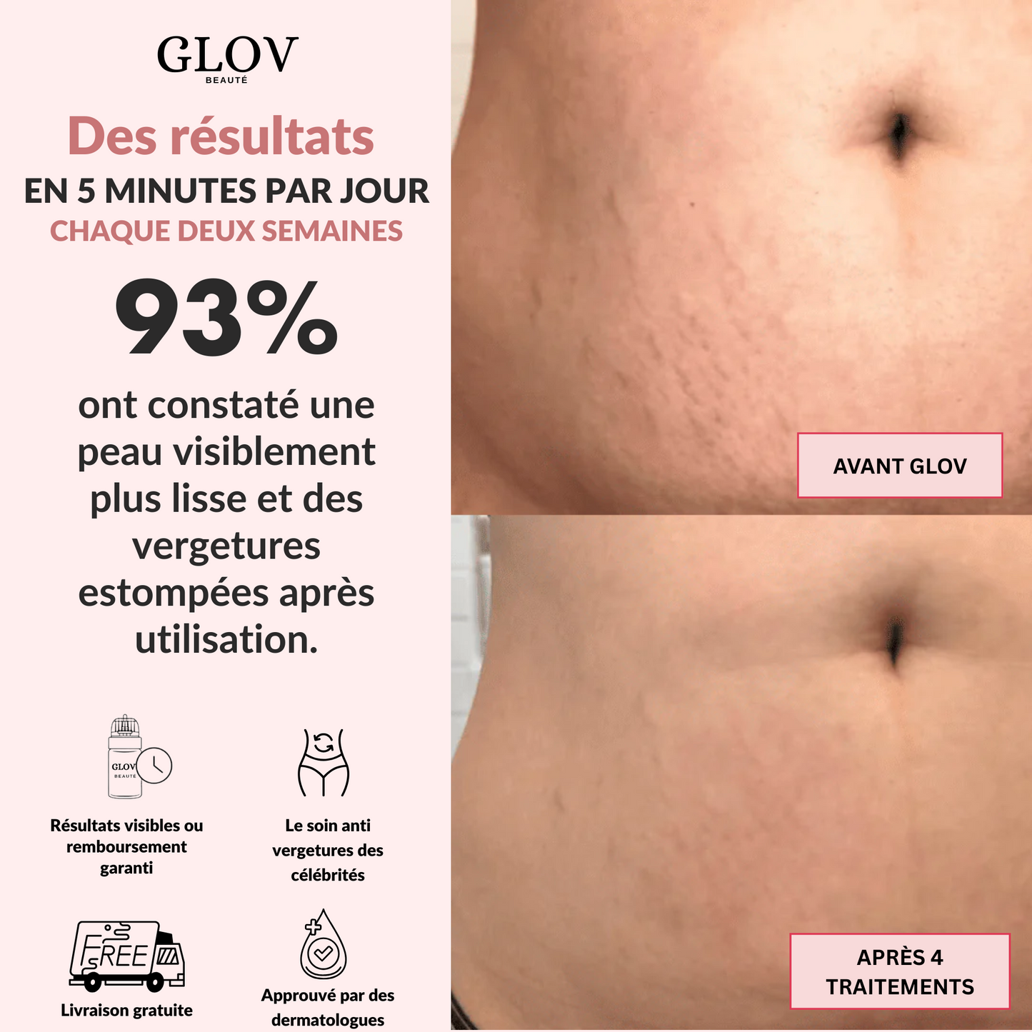 Kit Glov Beauté Vergeture