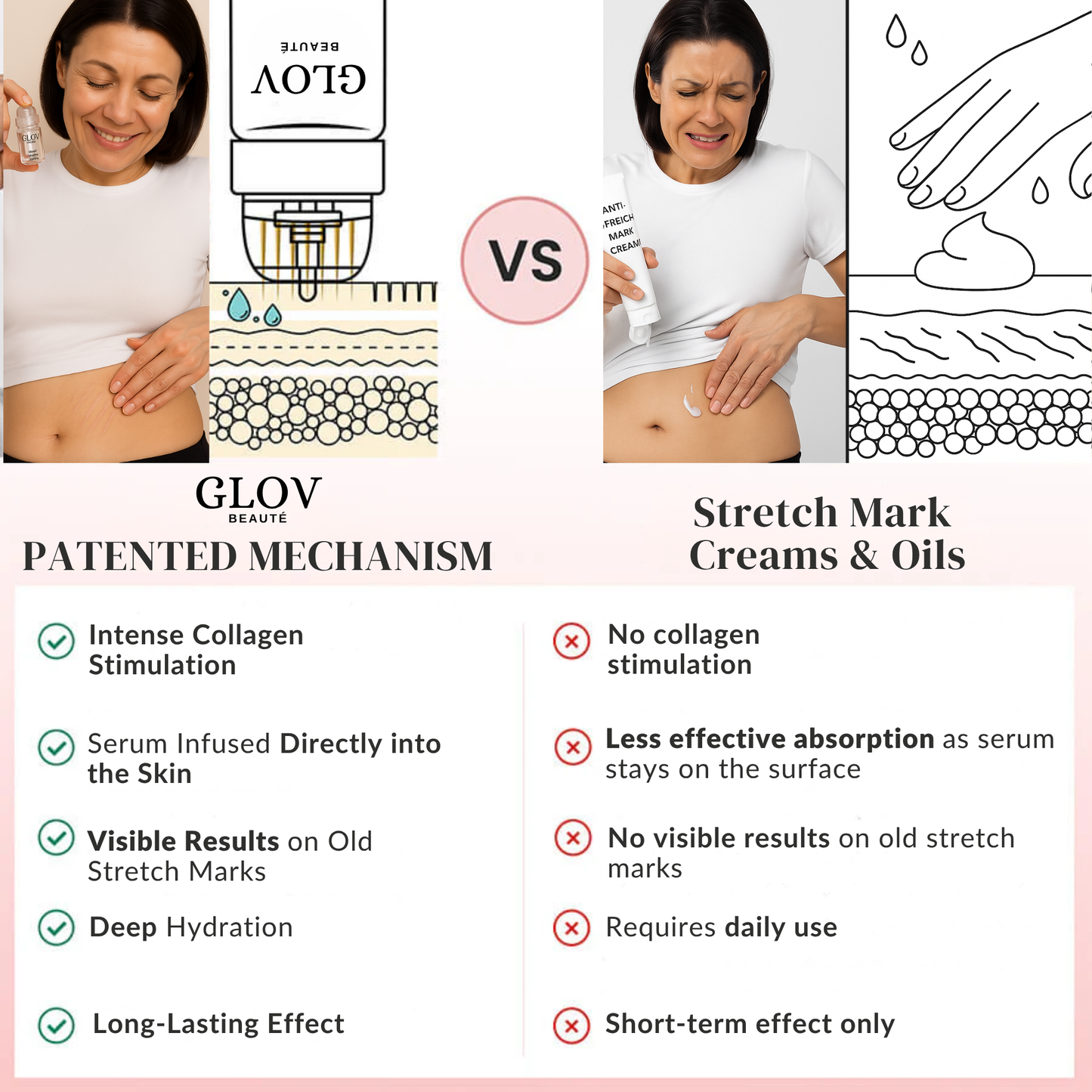 Glov Beauty Stretch Mark Kit