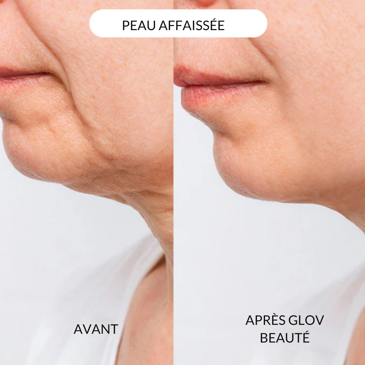 Système de micro perfusion Glov Beauté