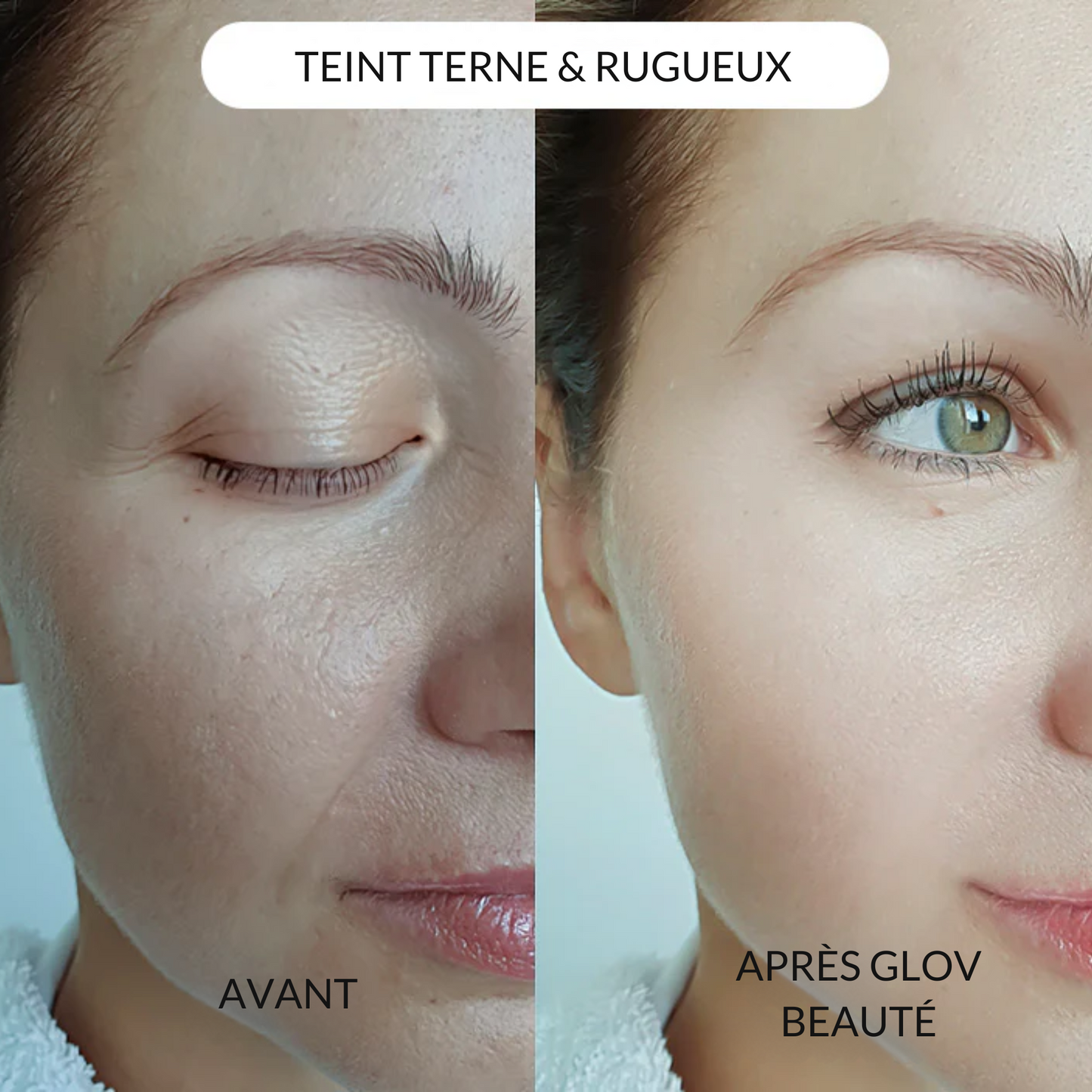 Système de micro perfusion Glov Beauté