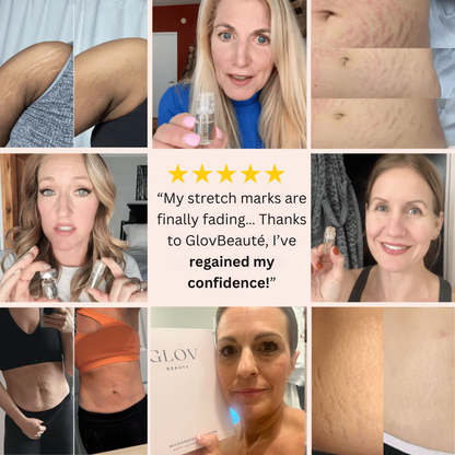 Glov Beauty Stretch Mark Kit
