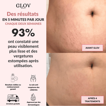 Kit Glov Beauté Vergeture